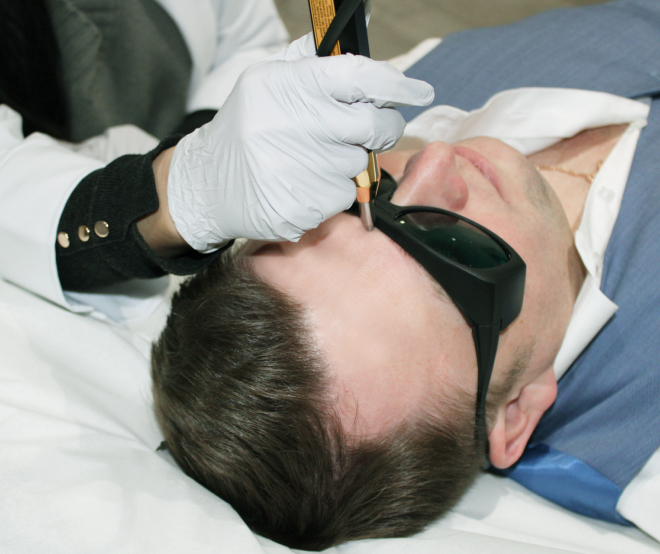 Smoking Cessation Laser Therapy